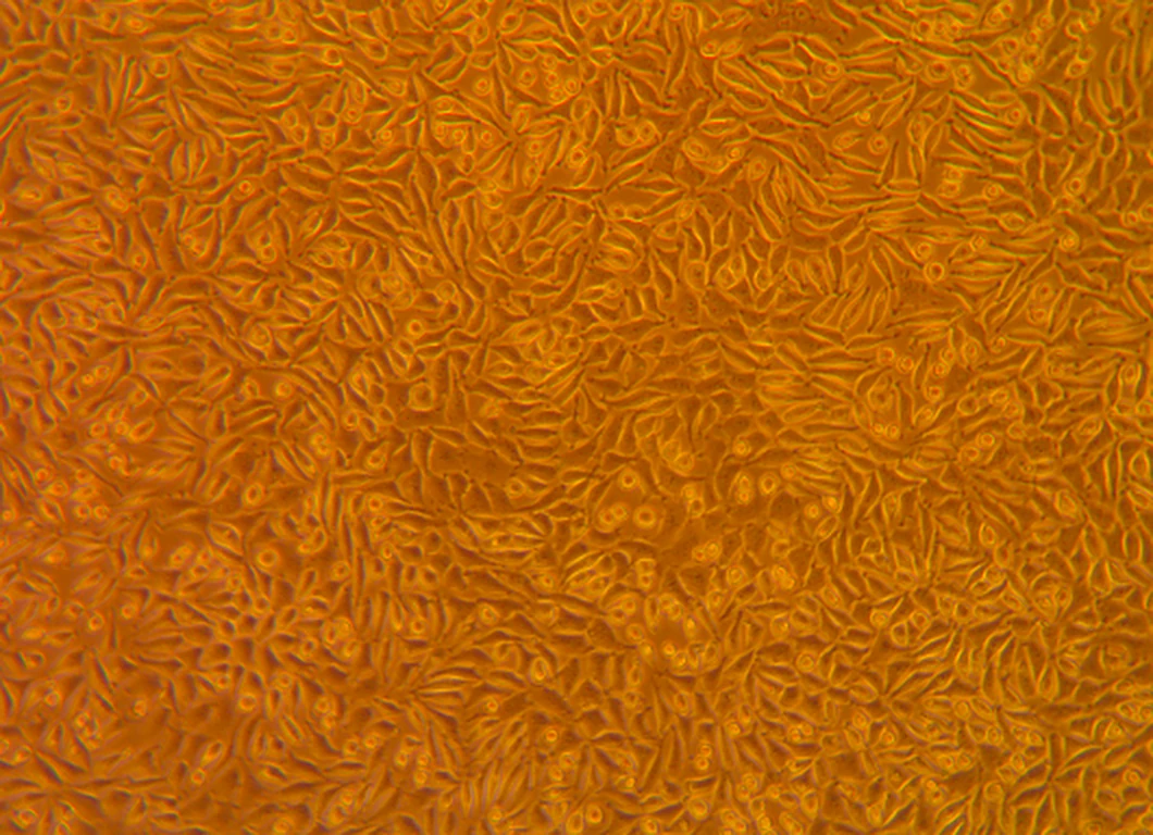 Micrograph of a healthy, confluent culture of spindle-shaped cells