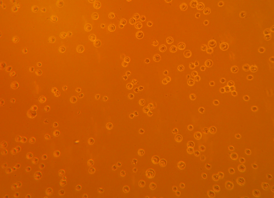 Micrograph of cells exposed to a competitor resin: sparse, rounded, dead cells