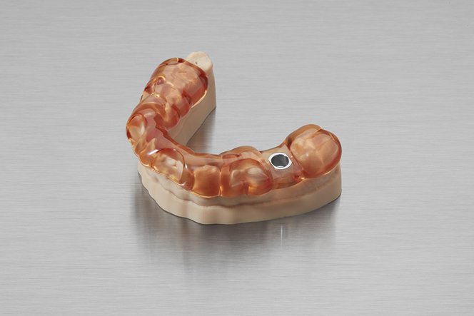 Dental Model
