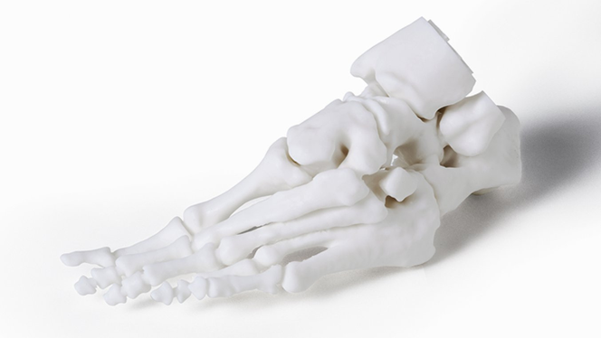 Surgery-3D Printing Use Cases Prosthetics