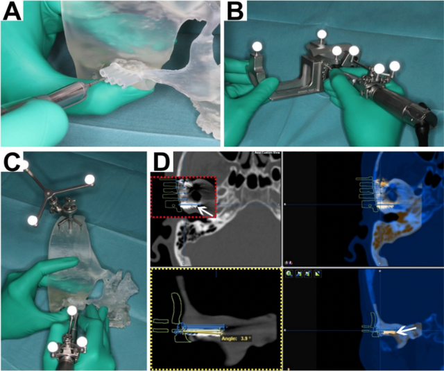 Medical 3D Printing Literature Roundup: CMF Guides | Formlabs